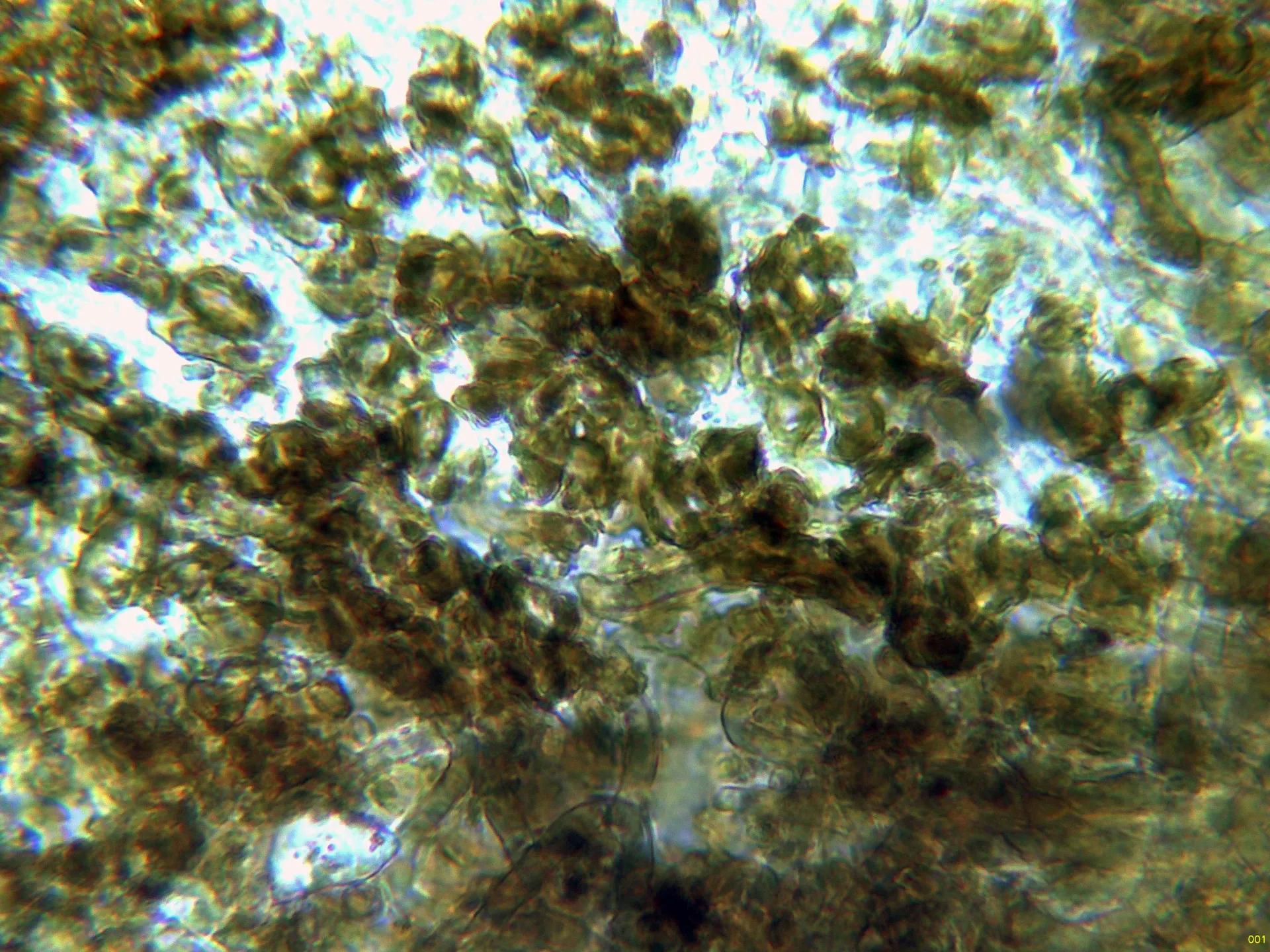 Microscopía de Perrotia flammea - 12 - Base pelos agua-001